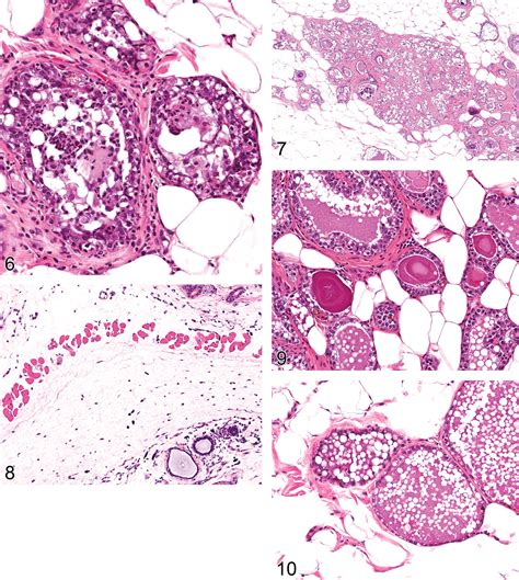 Proliferative And Nonproliferative Lesions Of The Rat And Mouse Mammary