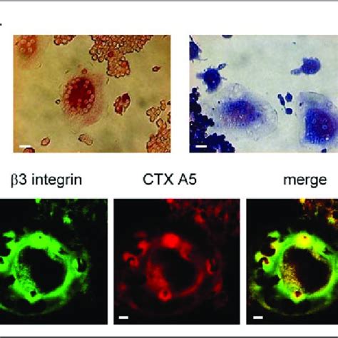 CTX A5 Partially Co Localizes With 3 Integrin In Osteoclasts A The