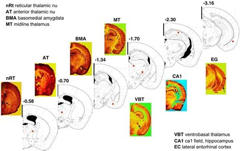 Superimposed Slice Drawings Made From The Stereotaxic Mouse Brain