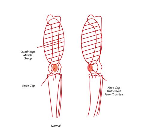 Patellar Luxation Dog Knee Surgery Cardiff Cardiff Canine Knee Clinic