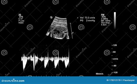 Echografisch Onderzoek Van Het Hart Van De Foetus Stock Illustratie