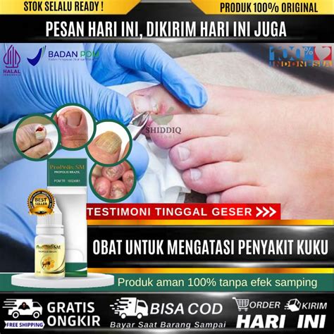 Jual Obat Tetes Cantengan Jempol Ibu Jari Kaki Bengkak Obat Nyeri