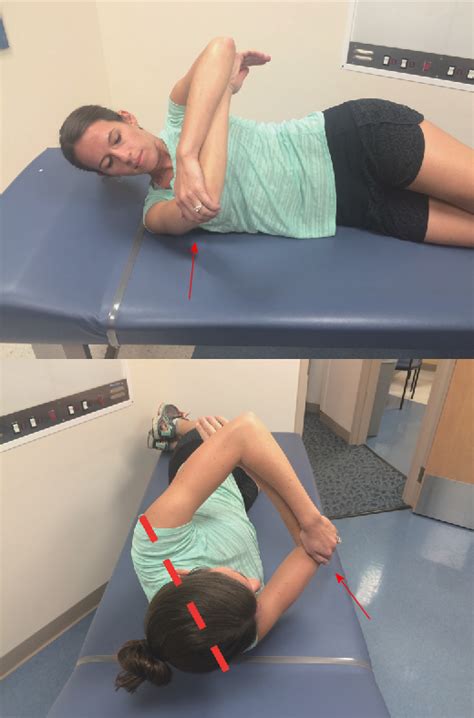 Figure 2 From Elbow Ulnar Collateral Ligament Injuries In Athletes Can We Improve Our Outcomes