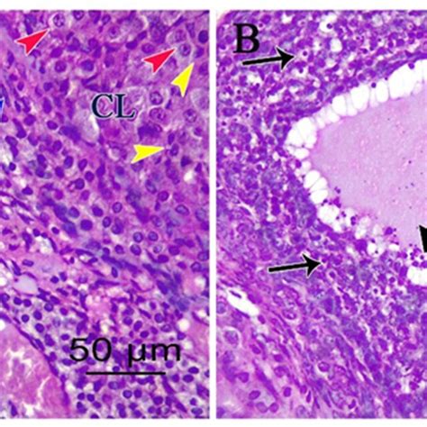 Photomicrographs Of H E 400 Stained Ovarian Sections Of Cisplatin