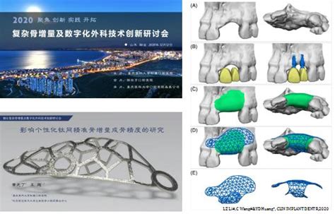 重医大附属口腔医院成功举办复杂骨增量及数字化外科技术创新研讨会 每日头条