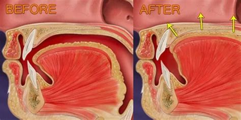 How Mewing Works: Scientific Insights and Practical Guide – Mewinghub 