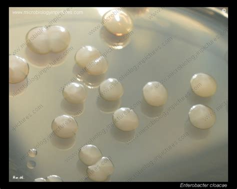 Enterobacter cloacae colony morphology on tryptic soy agar. Colony ...