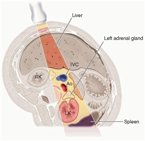 The Adrenal Glands Radiology Key