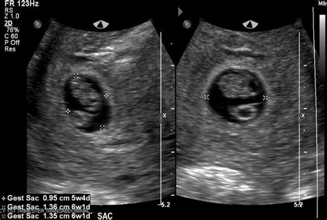 SonoCat Practical Guide To General Sonography