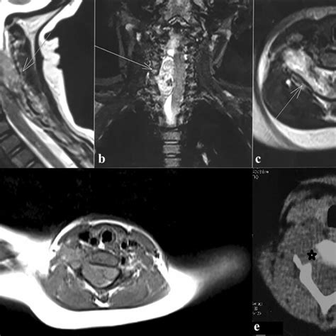 T2w Sagittal A Coronal B Axial C And T1w Axial D Magnetic