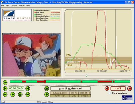 PEAT Photosensitivity Epilepsy Analysis Tool | GPII DeveloperSpace