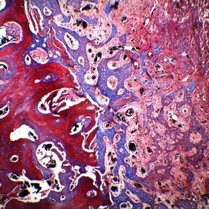 A Goldner S Masson Trichrome Staining Section Exhibiting The Presence