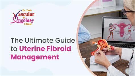 The Ultimate Guide To Uterine Fibroid Management