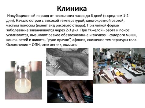 Кишечные инфекции - презентация онлайн