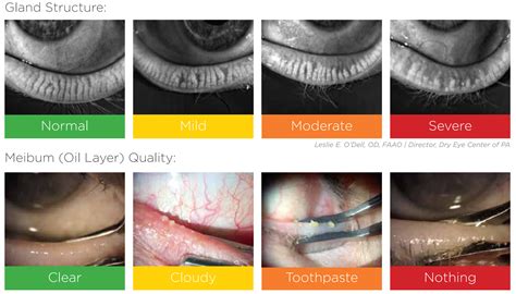 Henderson Vision Care Optometry In Henderson Nv Us