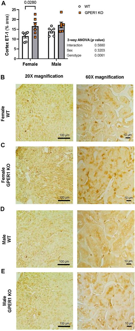 Frontiers G Protein Coupled Estrogen Receptor 1 Regulates Renal Endothelin 1 Signaling System