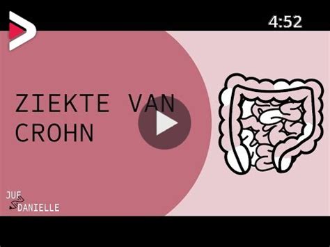 Ziekte van Crohn دیدئو dideo