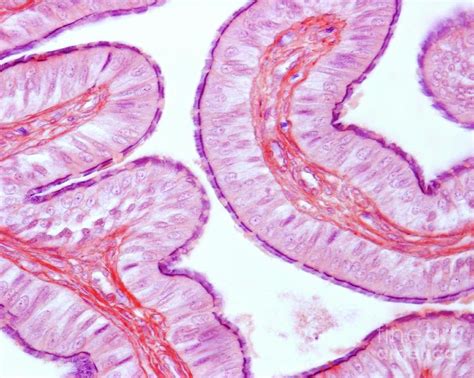 Simple Columnar Ciliated Epithelium Fallopian Tube