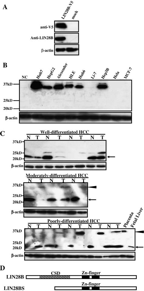 Identification And Distribution Of LIN28B Isoforms A Western Blot