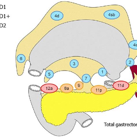 Lymph Node Dissection In Pylorus Preserving Gastrectomy Lymph Node