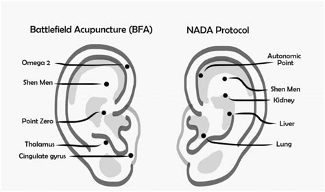 Sample points for auricular acupuncture | Download Scientific Diagram