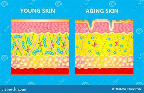 The Diagram Of Younger Skin And Aging Skin Stock Illustration