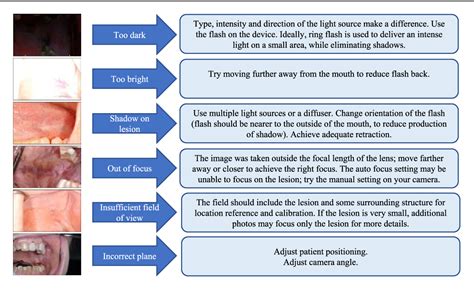 Figure From Intraoral Photography Recommendations For Remote Risk