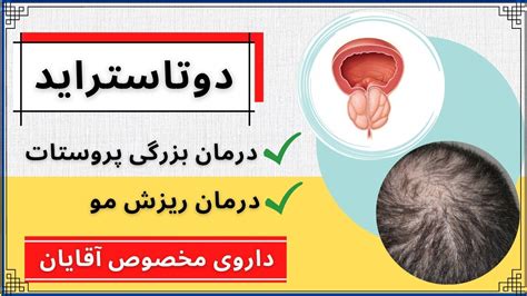 درمان ریزش مو با الگوی مردانه و بزرگ شدن پروستات با داروی دوتاستراید