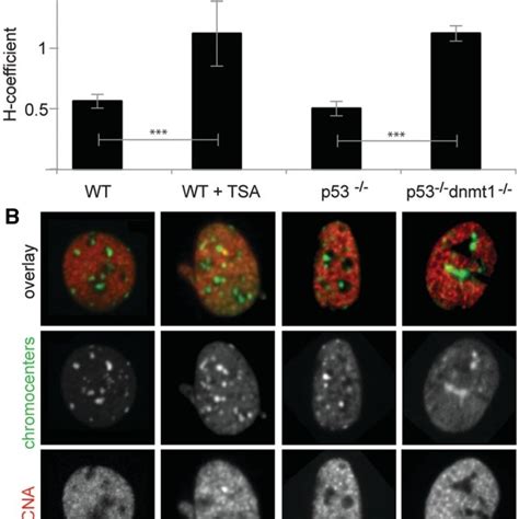 Histone Hyperacetylation At Heterochromatic Regions Increase Their