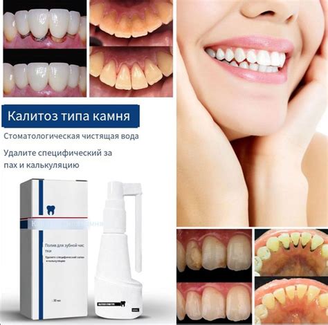 Спрей для очищения зубного камня - купить с доставкой по выгодным ценам ...