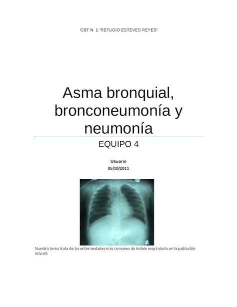 DOCX Asma Bronquial Bronconeumonia Y Neumonia DOKUMEN TIPS