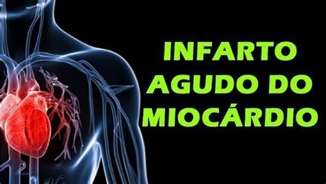 Infarto Agudo Do Miocárdio Causas E Sintomas Buscar Saúde