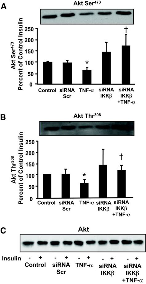 Akt Ser And Thr Phosphorylation Representative Immunoblot