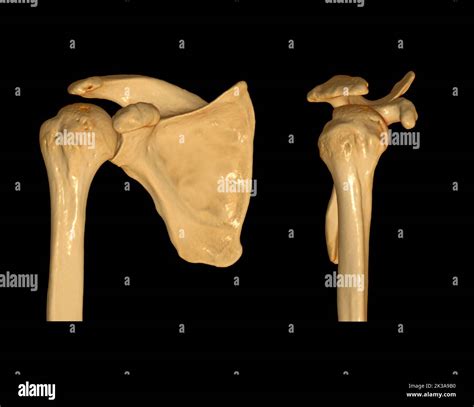 Ct Shoulder D Of Computed Tomography Volume Rendering Examination Of