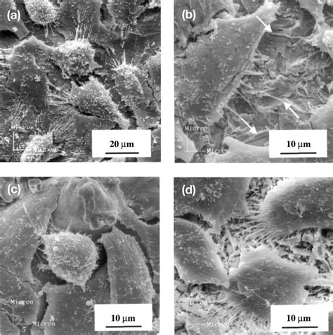 Scanning electron microscopy images (20006) showing the morphology and ...