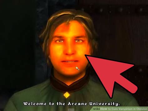 Protecting Yourself From Sun Damage As A Vampire In Oblivion | Justinboey