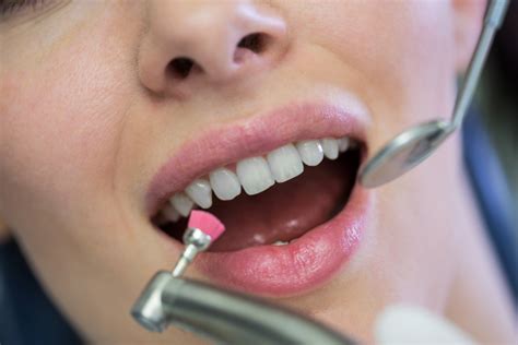 Dental Deep Cleaning Vs Regular Cleaning Teeth Which Is Useful