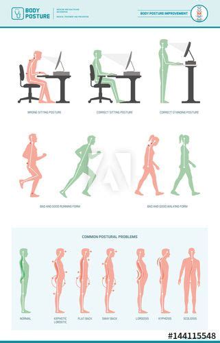 Improving Body Posture for Better Ergonomics