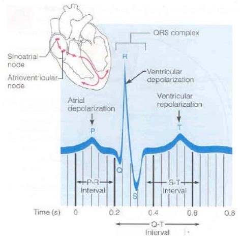 An Electrocardiogram Tracing Lead 1 Illustrating The Three Normally