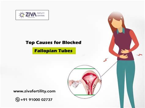 Fallopian Tube Blockage