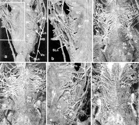 Stylopharyngeus muscle | Semantic Scholar