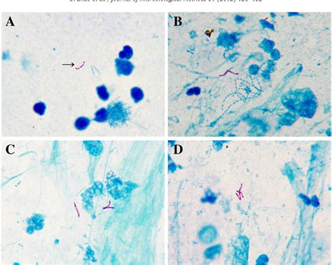 Mycobacterium Leprae Acid Fast