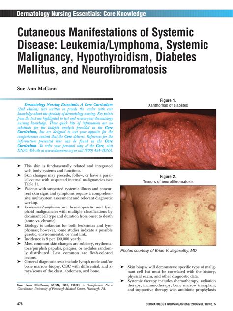 Pdf Cutaneous Manifestations Of Systemic Disease Leukemia Lymphoma