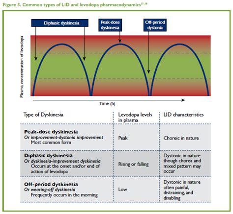 The Need For Enhanced Strategies To Manage Levodopa Induced Dyskinesia