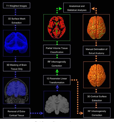 Figure 1 From Mapping Cortical Gray Matter In The Young Adult Brain