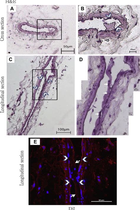 Histological Analysis Of The Pvs In Lymph Ducts A And B Cross