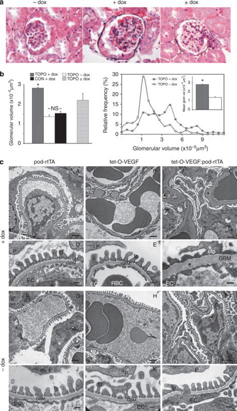 Overexpression Of Vegf A In Podocytes Of Adult Mice Causes Glomerular