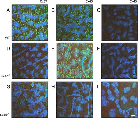 Mouse Aortic Endothelial Cells Express Cx And Cx At Cell Cell