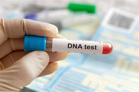 Berapa Biaya Yang Dibutuhkan Untuk Tes Dna Ini Gambarannya Halaman