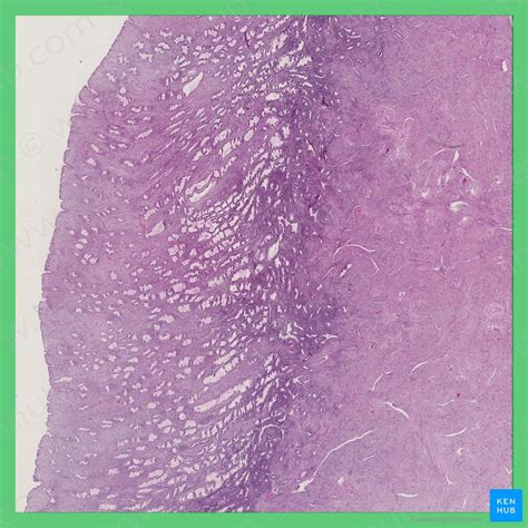 Uterus Histology